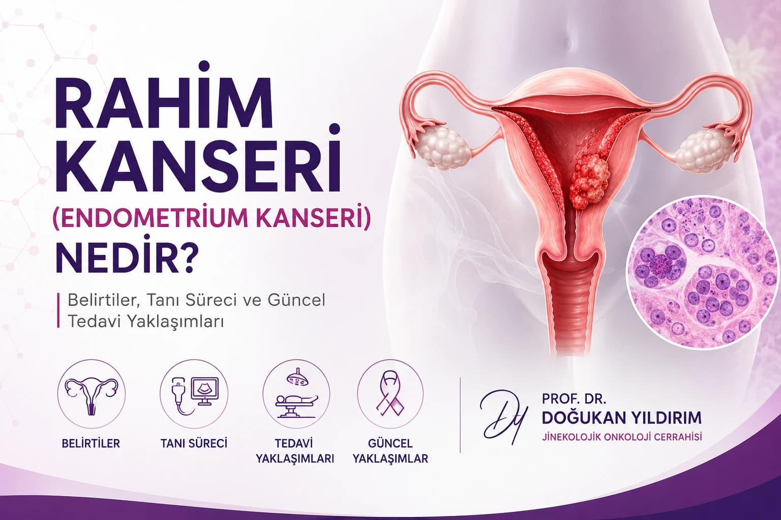 Rahim kanseri (endometrium kanseri) için belirtiler, tanı süreci, görüntüleme yöntemleri ve güncel tedavi yaklaşımlarını gösteren medikal illüstrasyon