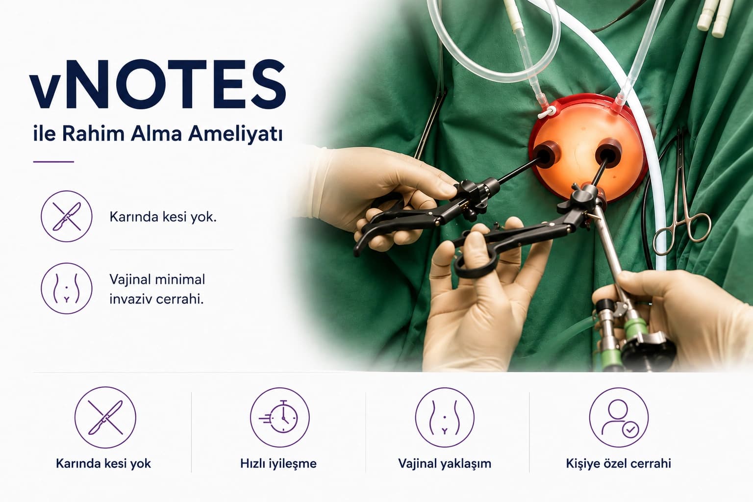 vNOTES ile rahim alma ameliyatını gösteren gerçek ameliyat görüntüsü ve minimal invaziv vajinal cerrahi yaklaşımını anlatan infografik