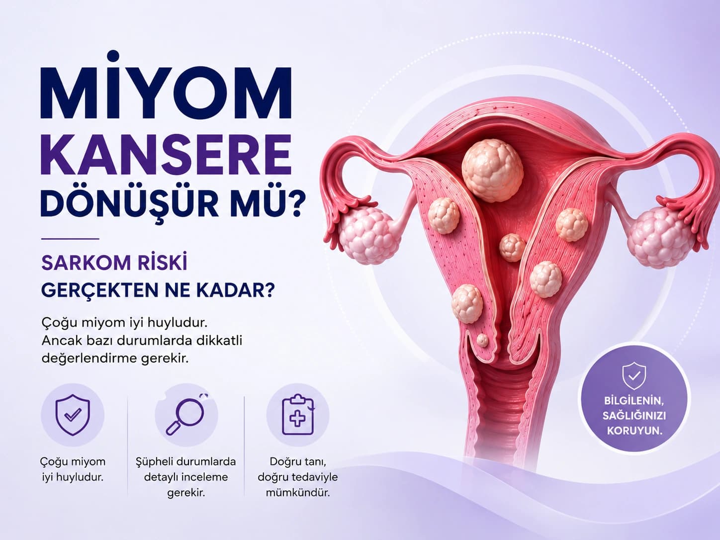 Miyomların kansere dönüşme ihtimalinin düşük olduğunu anlatan tıbbi illüstrasyon