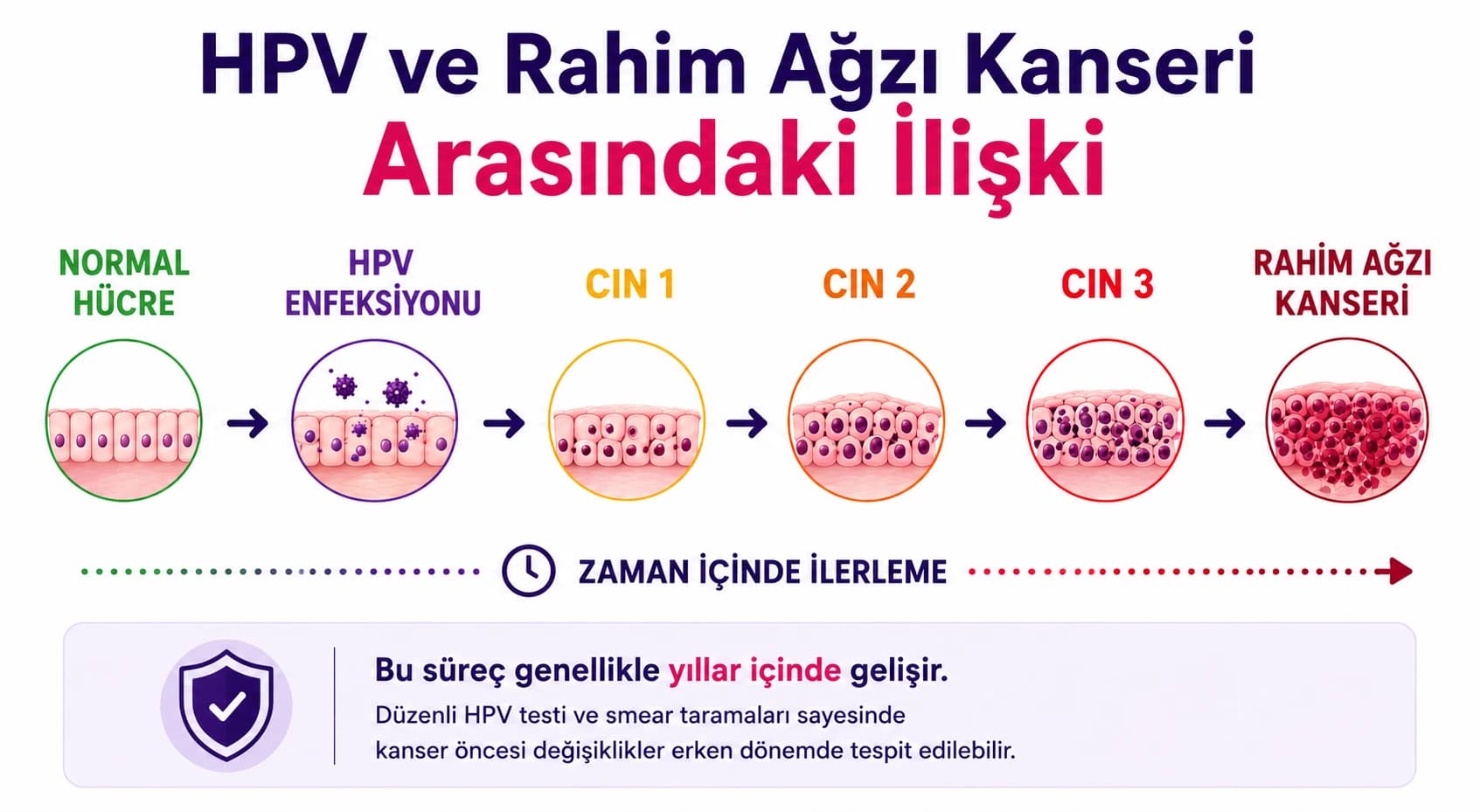 HPV enfeksiyonu ile rahim ağzı kanseri arasındaki ilişkiyi ve yıllar içinde gelişebilen hücresel değişiklikleri gösteren infografik.