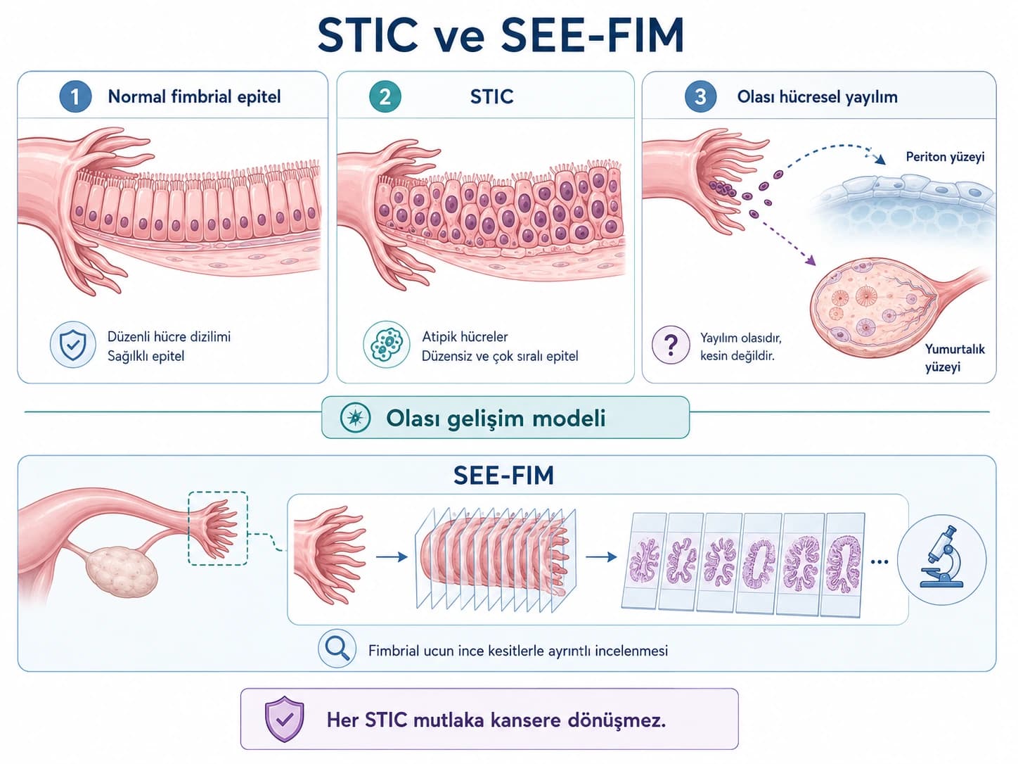 Normal fimbrial epitel, STIC, olası hücresel yayılım ve SEE-FIM ile fimbrial ucun ayrıntılı patolojik incelenmesini gösteren tıbbi infografik.