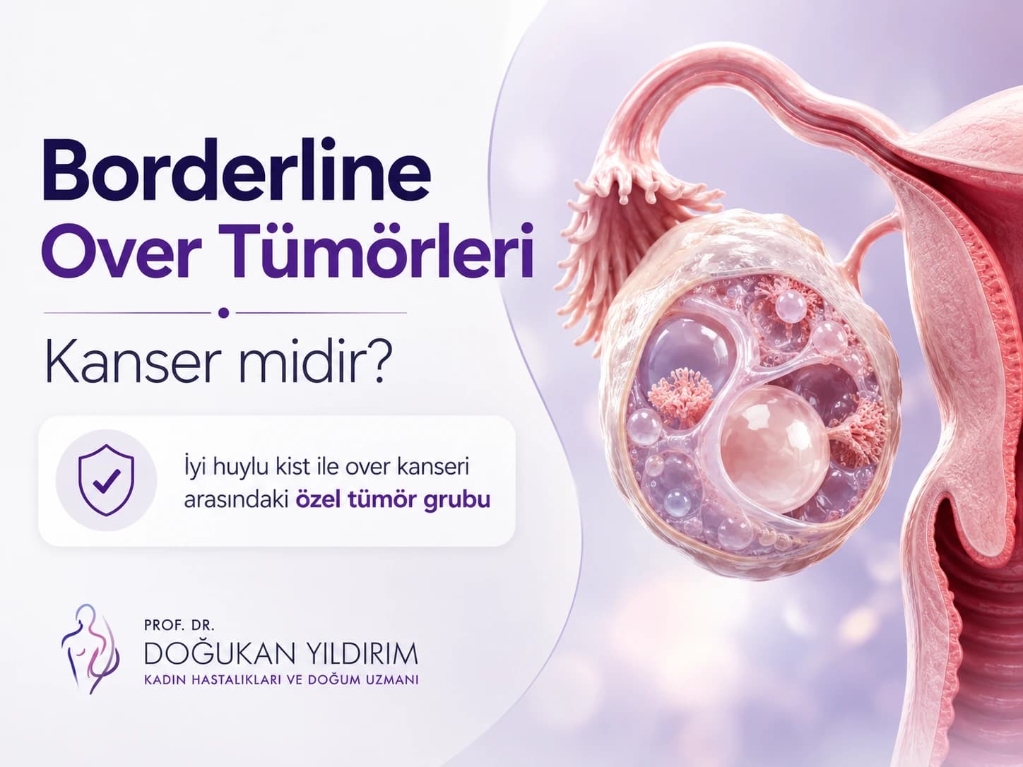 Borderline Over Tümörleri: Kanser midir? Belirtiler ve Tedavi