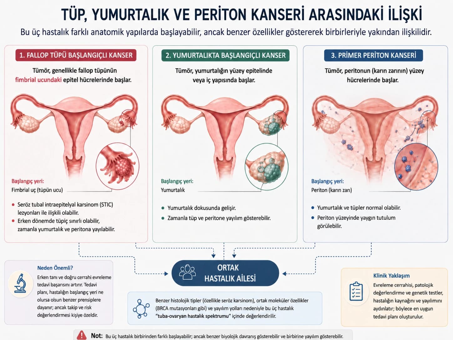Fallop tüpü, yumurtalık ve primer periton kanserlerinin farklı başlangıç bölgelerini ve ortak hastalık özelliklerini gösteren tıbbi infografik.