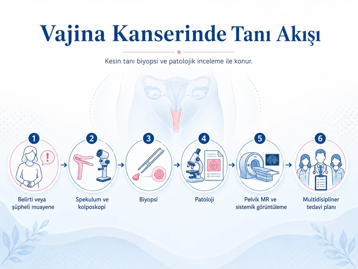 Vajina kanserinde belirti veya şüpheli muayeneden biyopsi, patoloji, pelvik MR ve multidisipliner tedavi planına uzanan tanı akışını gösteren infografik.