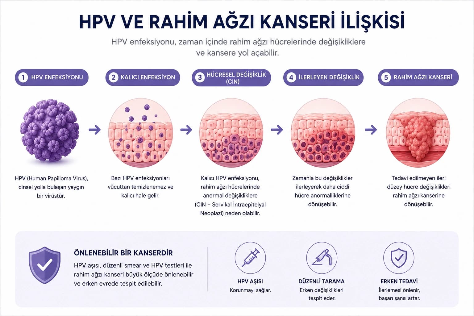 HPV enfeksiyonundan rahim ağzı kanseri gelişimine kadar olan süreci gösteren, kalıcı HPV enfeksiyonu, CIN lezyonları ve servikal kanser ilişkisini açıklayan tıbbi bilgilendirme görseli.