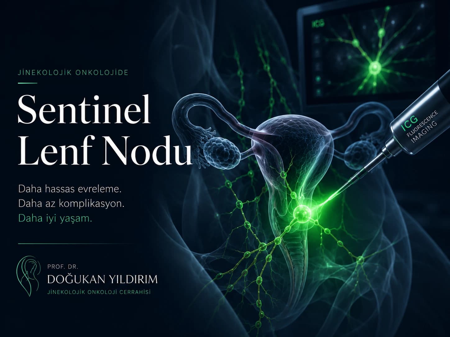 Sentinel lenf nodu cerrahisinde ICG floresan görüntüleme ile pelvik lenfatik haritalamanın gösterildiği jinekolojik onkoloji illüstrasyonu