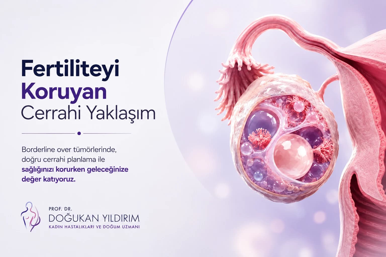 Borderline over tümörlerinde fertilite koruyucu cerrahi planlamayı anlatan tıbbi illüstrasyon