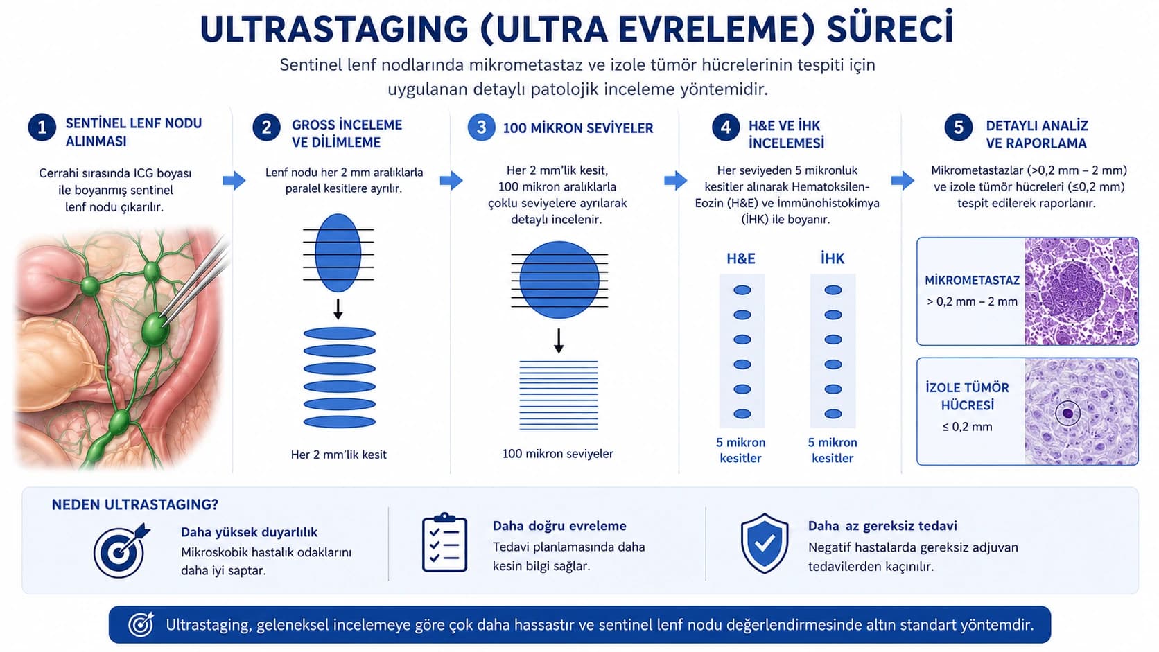 Ultrastaging sürecini gösteren infografik: Sentinel lenf nodunun 2 mm kesitlere ayrılması, 100 mikron seviyelerde incelenmesi ve H&E ile immünohistokimya değerlendirmesi