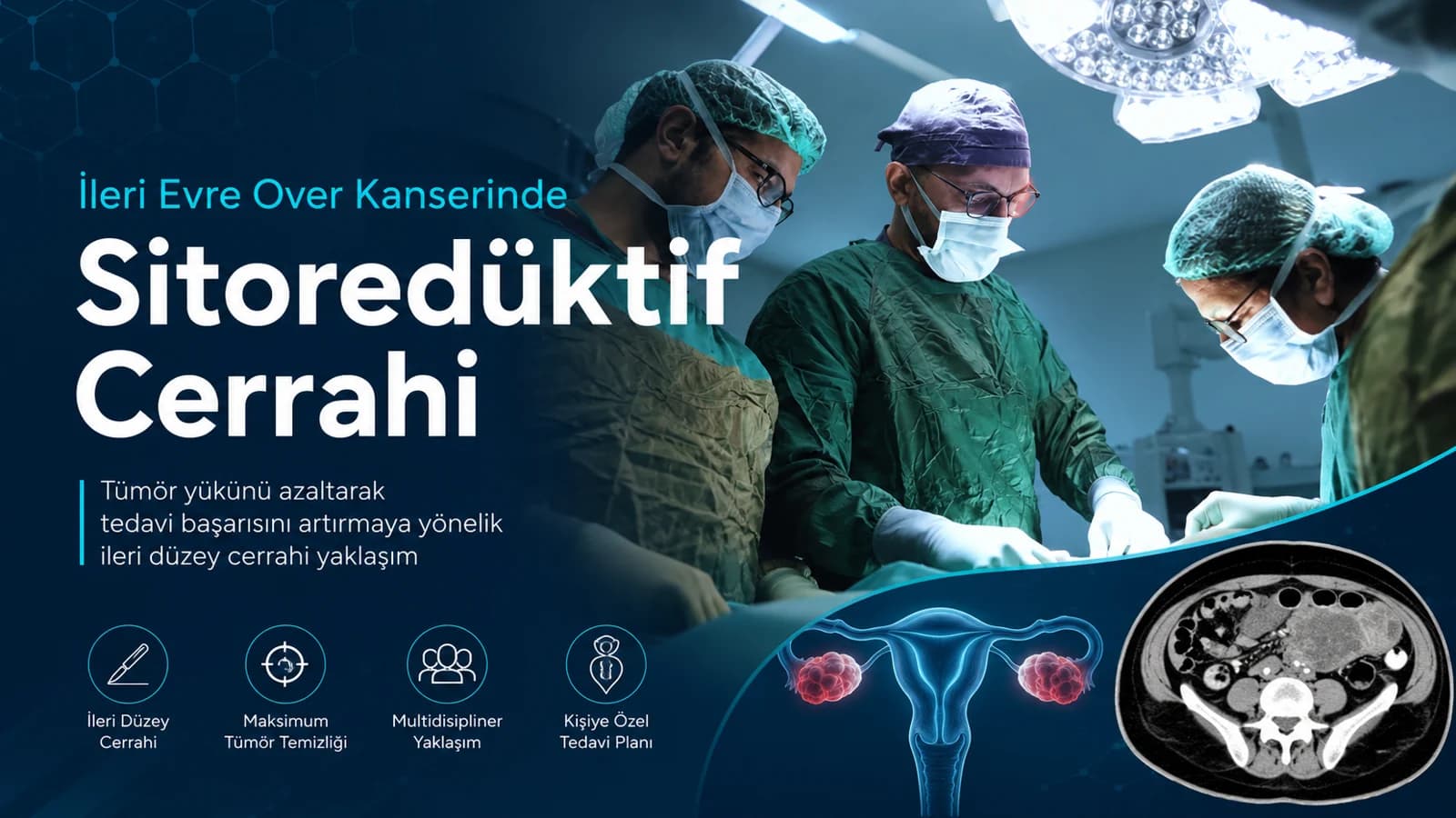 ileri evre over kanseri ameliyatında sitoreduktif cerrahi ve multidisipliner tümör temizligi yaklasimi