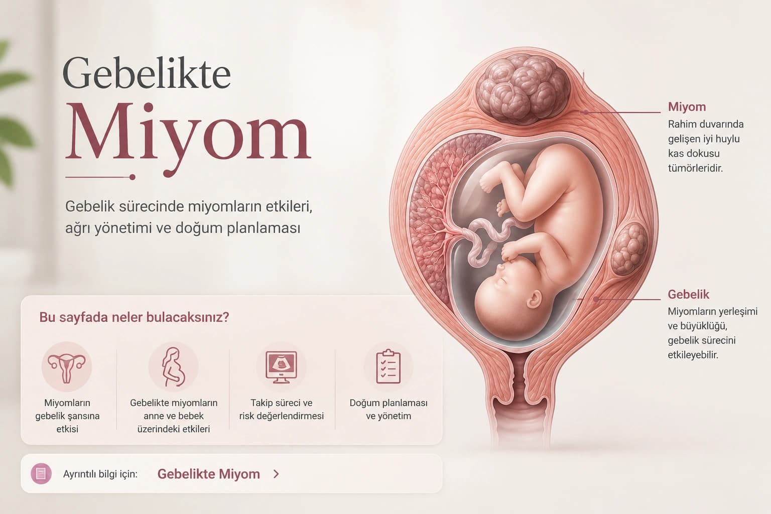 Gebelikte miyomların rahim içindeki yerleşimini ve gebelik sürecine olası etkilerini gösteren medikal illüstrasyon